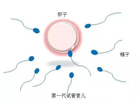 取卵手术室